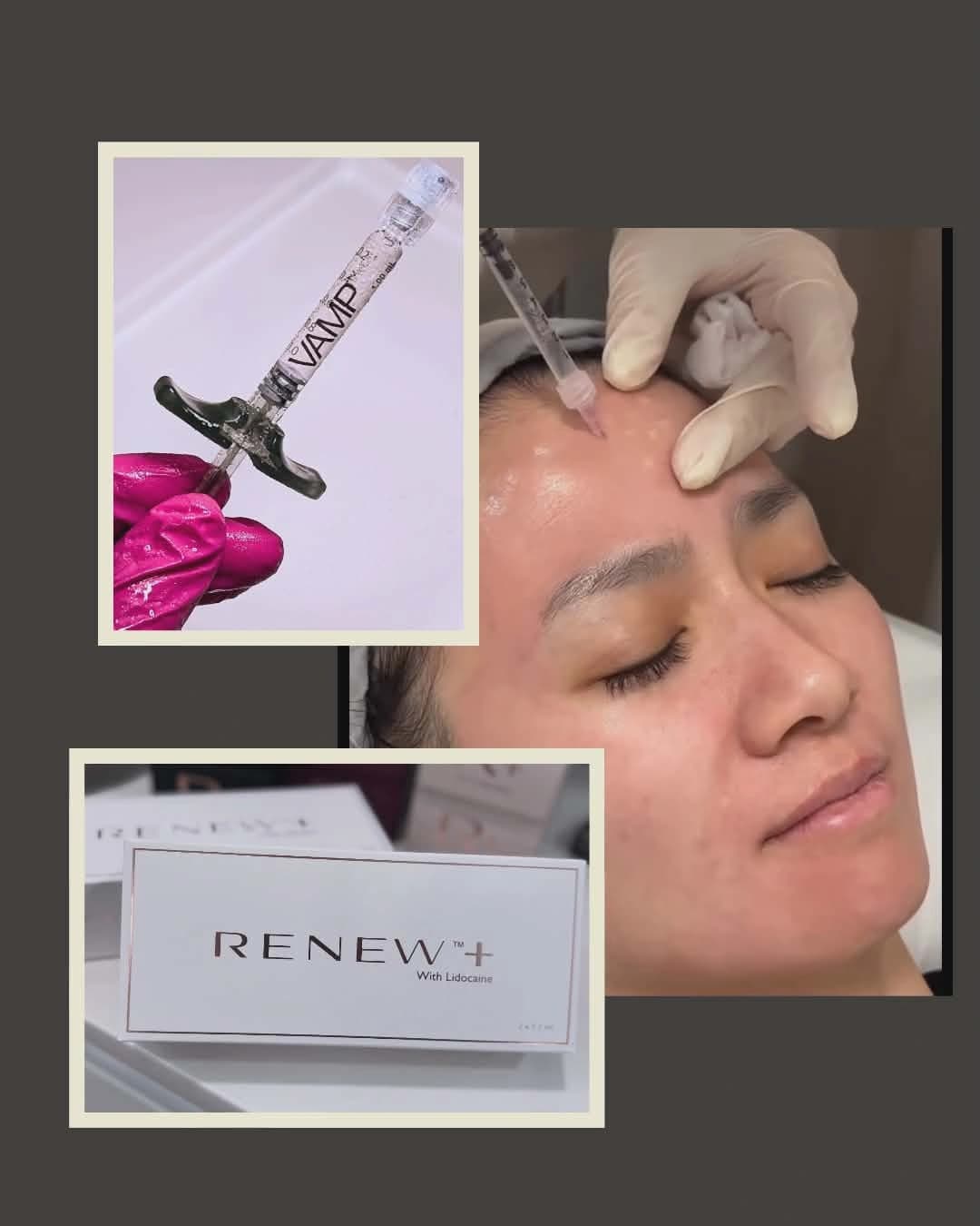 Mesotherapy and skin boosters